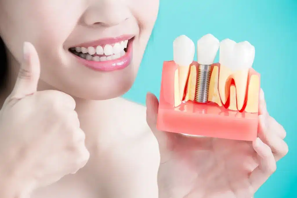 Dental Implant Placement vs Implant Restoration Whats the Difference