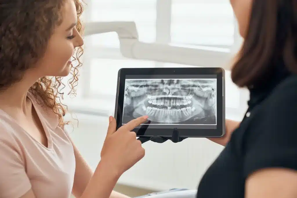 Osseointegration and Dental Implant Treatment